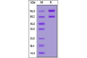 Biotinylated Human IL-2RB&IL-2RA&IL-2RG, Fc,Avitag&Fc,Avitag on  under reducing (R) condition.