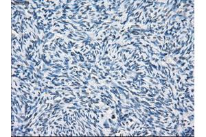 Immunohistochemical staining of paraffin-embedded colon tissue using anti-PSMA7mouse monoclonal antibody. (PSMA7 antibody)