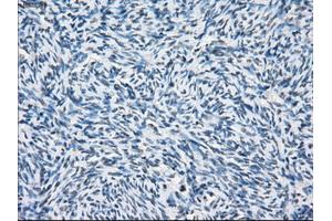 Immunohistochemical staining of paraffin-embedded colon tissue using anti-PSMA7mouse monoclonal antibody.