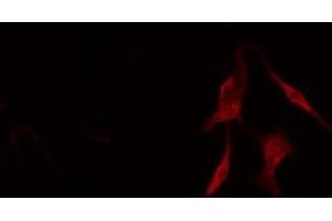 ABIN6276561 staining COLO205 cells by IF/ICC. (BCL2L2 antibody  (N-Term))