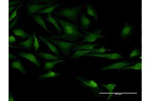 Immunofluorescence of monoclonal antibody to TSGA10 on HeLa cell. (TSGA10 antibody  (AA 599-698))