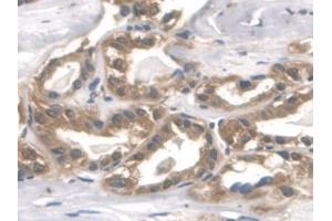 Immunohistochemistry (IHC) image for anti-Aldolase A, Fructose-Bisphosphate (ALDOA) (AA 18-273) antibody (ABIN7440131)