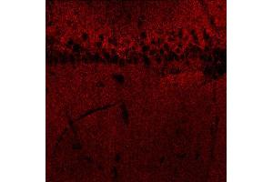 Indirect immunostaining of a rat hippocampus section fixed with 4 % PFA and 15 % picric acid (dilution 1 : 500). (GABRB3 antibody  (AA 344-429))