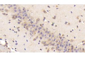 Detection of BNP in Mouse Cerebrum Tissue using Polyclonal Antibody to Brain Natriuretic Peptide (BNP) (BNP antibody  (AA 77-121))