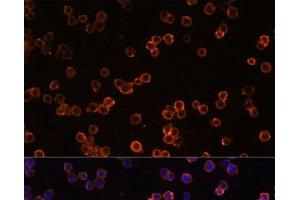 Immunofluorescence analysis of Raw264. (CD39 antibody)