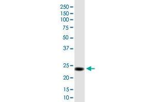 MGC50273 monoclonal antibody (M01), clone 3B10. (MGC50273 (AA 1-209) antibody)