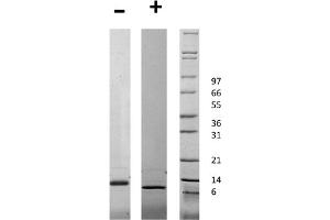 SDS-PAGE of Human Connective Tissue Growth Factor Recombinant Protein SDS-PAGE of Human Connective Tissue Growth Factor Recombinant Protein. (CTGF Protein)