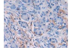 Detection of HLA-DRB1 in Human Pancreas Tissue using Polyclonal Antibody to HLA Class II Histocompatibility Antigen, DRB1 Beta Chain (HLA-DRB1)