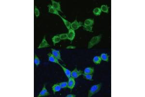 Immunofluorescence analysis of NIH-3T3 cells using MTHFD2 antibody (ABIN6132367, ABIN6144144, ABIN6144145 and ABIN6214625) at dilution of 1:100. (MTHFD2 antibody  (AA 40-250))