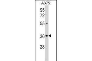 Western blot analysis of GALE Antibody (Center) (ABIN390889 and ABIN2841099) in  cell line lysates (35 μg/lane). (GALE antibody  (AA 142-171))