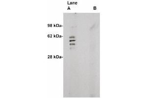 Image no. 1 for anti-Sphingomyelin Synthase 2 (SGMS2) antibody (ABIN265116)
