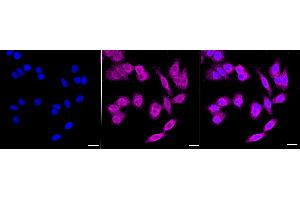 Immunocytochemical staining of HepG2 cells with Ferritin heavy chain 1 antibody (ABIN7798596), 1:1,000).