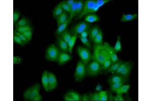 Immunofluorescence staining of HepG2 cells with ABIN7154041 at 1:100, counter-stained with DAPI. (PET112L antibody  (AA 301-383))