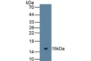 Detection of Recombinant MUC2, Human using Monoclonal Antibody to Mucin 2 (MUC2) (MUC2 antibody  (AA 5075-5179))