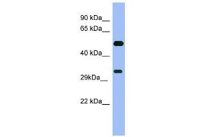 MAGEB1 antibody used at 1 ug/ml to detect target protein. (MAGEB1 antibody  (Middle Region))