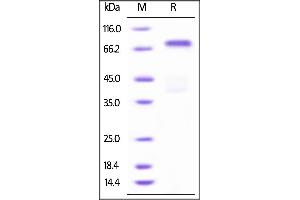 Biotinylated Human HGF R, His Tag on SDS-PAGE under reducing (R) condition.