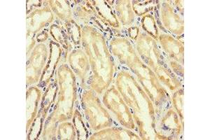 Immunohistochemistry of paraffin-embedded human kidney tissue using ABIN7144749 at dilution of 1:100 (DARS2 antibody  (AA 489-628))