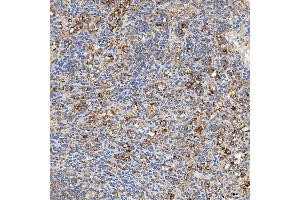 IHC analysis of SNPH using anti-SNPH antibody (ABIN7601724). (Syntaphilin antibody  (AA 43-482))