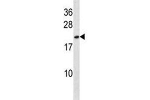 HMGB3 antibody western blot analysis in NCI-H292 lysate. (HMGB3 antibody  (AA 50-79))