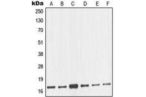 Western blot analysis of nm23-H2 expression in MCF7 (A), HeLa (B), A431 (C), Jurkat (D), K562 (E), BJAB (F) whole cell lysates. (NME2 antibody  (Center))