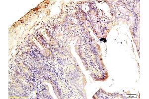Formalin-fixed and paraffin embedded rat intestine tissue labeled with Anti-Claudin 1 Polyclonal Antibody, Unconjugated (ABIN686407) followed by conjugation to the secondary antibody and DAB staining (Claudin 1 antibody  (AA 121-211))
