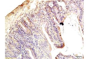 Formalin-fixed and paraffin embedded rat intestine tissue labeled with Anti-Claudin 1 Polyclonal Antibody, Unconjugated (ABIN686407) followed by conjugation to the secondary antibody and DAB staining