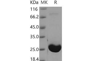 Western Blotting (WB) image for Adenylate Kinase 1 (AK1) protein (His tag) (ABIN7194158) (Adenylate Kinase 1 Protein (AK1) (His tag))