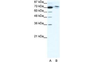 Human HepG2; WB Suggested Anti-C14ORF101 Antibody Titration: 0. (C14orf101 antibody  (N-Term))