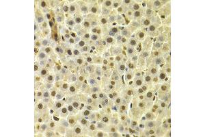 Immunohistochemistry of paraffin-embedded rat liver using DTNBP1 antibody at dilution of 1:100 (x400 lens). (DTNBP1 antibody)