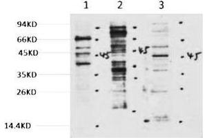 Western blot analysis of 1) Hela, 2) 3T3, 3) Rat Brain tissue, diluted at 1:2000. (Methylated Lysine antibody)