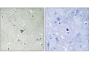 Immunohistochemistry analysis of paraffin-embedded human brain tissue, using Bax (Ab-184) Antibody.