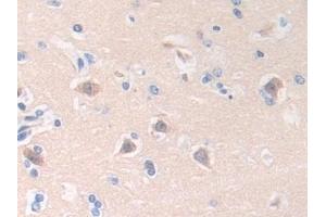 Detection of HLTF in Human Brain Tissue using Polyclonal Antibody to Helicase Like Transcription Factor (HLTF) (HLTF antibody  (AA 837-996))