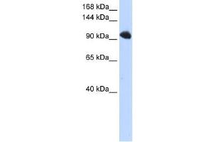 SFRS8 antibody used at 1 ug/ml to detect target protein. (SFRS8 antibody)