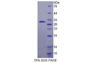 SDS-PAGE analysis of Cow CSN1 Protein.