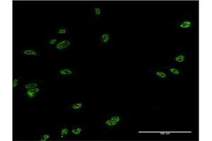 Immunofluorescence of monoclonal antibody to LHX4 on HeLa cell.