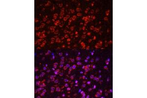 Immunofluorescence analysis of mouse brain using STAT3 antibody. (STAT3 antibody  (AA 640-770))