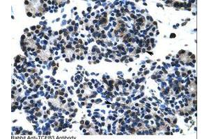 Image no. 1 for anti-Transcription Elongation Factor B (SIII), Polypeptide 3 (110kDa, Elongin A) (TCEB3) (C-Term) antibody (ABIN202907) (TCEB3 antibody  (C-Term))