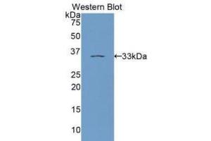 Western Blotting (WB) image for anti-Protein Kinase C, epsilon (PRKCE) (AA 403-672) antibody (ABIN1172891)