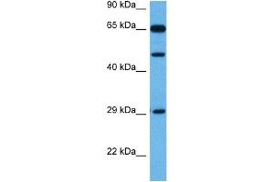 Host:  Rabbit  Target Name:  TP73  Sample Tissue:  Mouse Kidney  Antibody Dilution:  1ug/ml (Tumor Protein p73 antibody  (Middle Region))