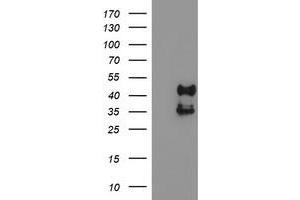 HEK293T cells were transfected with the pCMV6-ENTRY control (Left lane) or pCMV6-ENTRY PDSS2 (Right lane) cDNA for 48 hrs and lysed. (PDSS2 antibody)