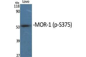 Western Blot (WB) analysis of specific cells using Phospho-MOR-1 (S375) Polyclonal Antibody. (Mu Opioid Receptor 1 antibody  (pSer375))