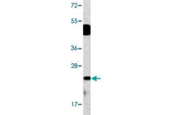DUSP14 anticorps  (N-Term)