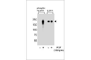 Western blot analysis of extracts from A431 cells, untreated or treated with EGF, using phospho EGFR- (left) or ErBB2 antibody (right) (EGFR antibody  (pTyr1172))