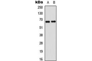 Western blot analysis of PAK1 expression in A431 (A), HEK293T (B) whole cell lysates. (PAK1 antibody  (Center))