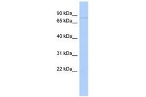 Image no. 1 for anti-Adrenergic, Beta, Receptor Kinase 2 (ADRBK2) (AA 71-120) antibody (ABIN6743615) (ADRBK2 antibody  (AA 71-120))