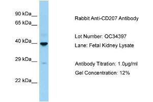 Host: Rabbit Target Name: CD207 Sample Type: Fetal Kidney Antibody Dilution: 1. (CD207 antibody  (C-Term))