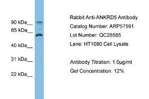 WB Suggested Anti-ANKRD5  Antibody Titration: 0. (ANKRD5 antibody  (N-Term))