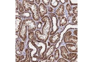 Immunohistochemical staining of human kidney with OR8S1 polyclonal antibody  shows strong cytoplasmic positivity in cells in tubules at 1:50-1:200 dilution. (OR8S1 antibody)