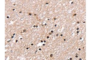 The image on the left is immunohistochemistry of paraffin-embedded Human brain tissue using ABIN7130904(RNF40 Antibody) at dilution 1/25, on the right is treated with fusion protein. (RNF4 antibody)