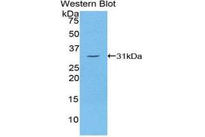Western Blotting (WB) image for anti-Thyroglobulin (TG) (AA 2083-2333) antibody (ABIN1078570) (Thyroglobulin antibody  (AA 2083-2333))